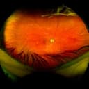 Steve Bloom